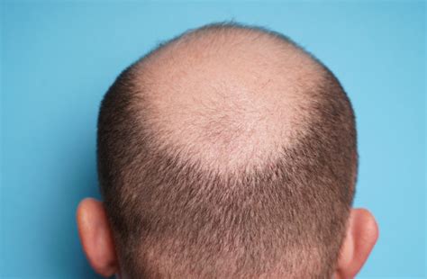Pornstar Flex Gamble Born: February 18 1967. Bald hair. Brown .